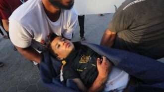 Injured Palestinian woman | Apaimages/SIPA/Newscom