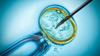 A closeup image of the IVF lab process | Nevodka | Dreamstime.com