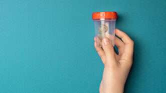 A urine drug testing cup | Illustration: Joanna Andreasson; Source images: pawelwizja, Irina Shatilova/iStock