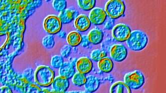 Hantavirus | ALFRED PASIEKA/SCIENCE PHOTO LIBRARY/Newscom