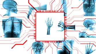 An illustration of X-ray images along with computer and robot imagery | Illustration: Joanna Andreasson; Source images: iStock