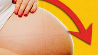 A pregnant woman's stomach with a down red arrow | Scaliger/Dreamstime. Illustration: Fatima Ruiz.