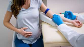 A doctor preps a pregnant person's arm for a blood draw | Photo: AndreyPopov/Newscom