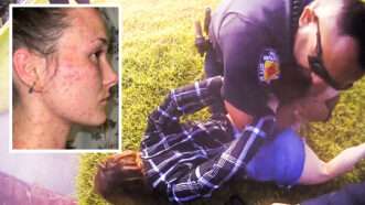 fire ant bites on Taylor Rogers next to a picture of Rogers handcuffed and held on the ground by law enforcement | Randy Kallinen