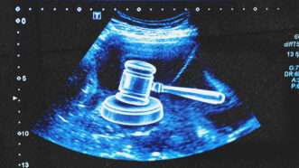 An ultrasound image showing a judge's gavel | Photo: Kohanova/Envato (AI-modified)