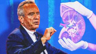 Health and Human Services Secretary Robert F. Kennedy Jr. and a graphic of a kidney | Illustration: BONNIE CASH/UPI/Newscom/Peakstock/Envato