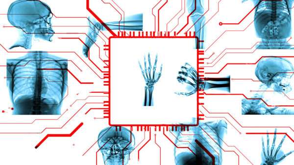 An illustration of X-ray images along with computer and robot imagery | Illustration: Joanna Andreasson; Source images: iStock