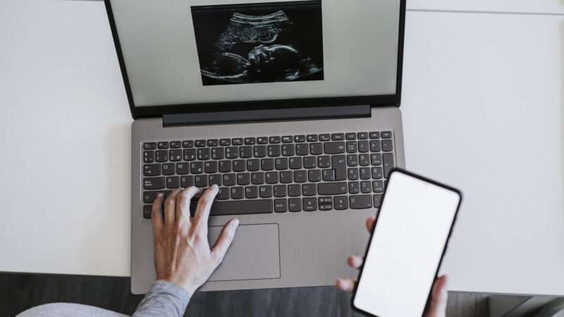 woman on computer looking at ultrasound photo