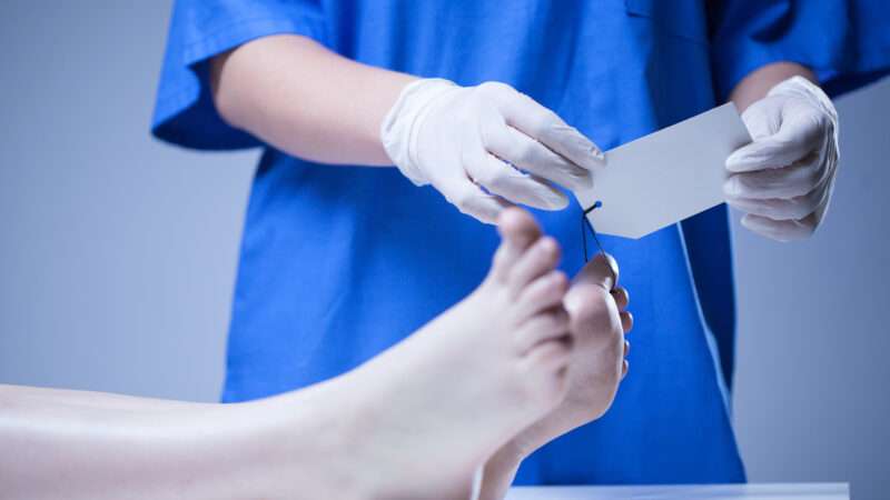 A nurse attaches a tag to a deceased person's toe in a morgue | Katarzyna Bialasiewicz | Dreamstime.com