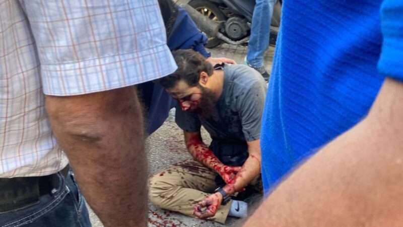 An injured Lebanese man with blood on his arm | EyePress/Newscom