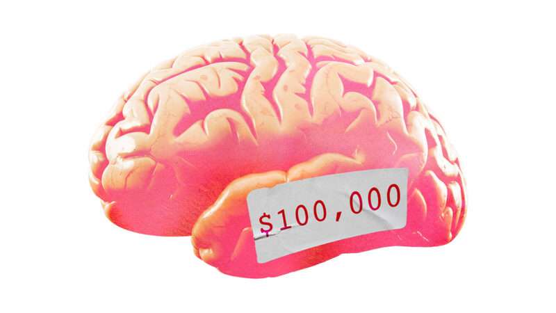 An illustration of a brain with a $100,000 price tag on it | Illustration: Joanna Andreasson; Source image: iStock