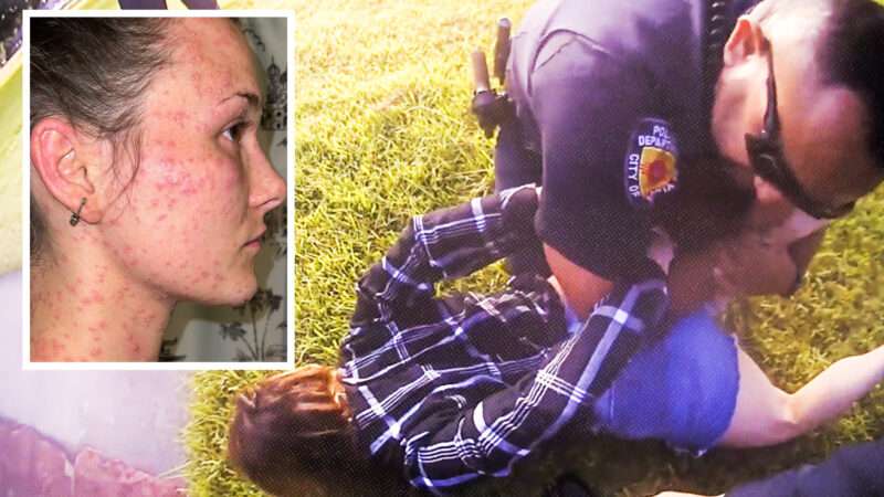 fire ant bites on Taylor Rogers next to a picture of Rogers handcuffed and held on the ground by law enforcement | Randy Kallinen