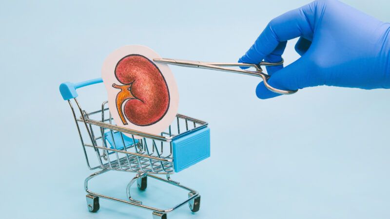 reason-kidney3 | Anastasiia Soloveva/Dreamstime.com