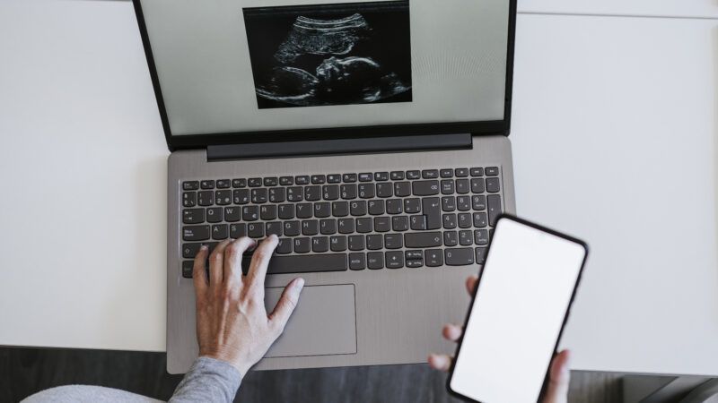 woman on computer looking at ultrasound photo