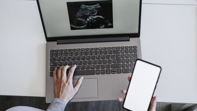 woman on computer looking at ultrasound photo | Eva Blanco/Westend61 GmbH/Newscom