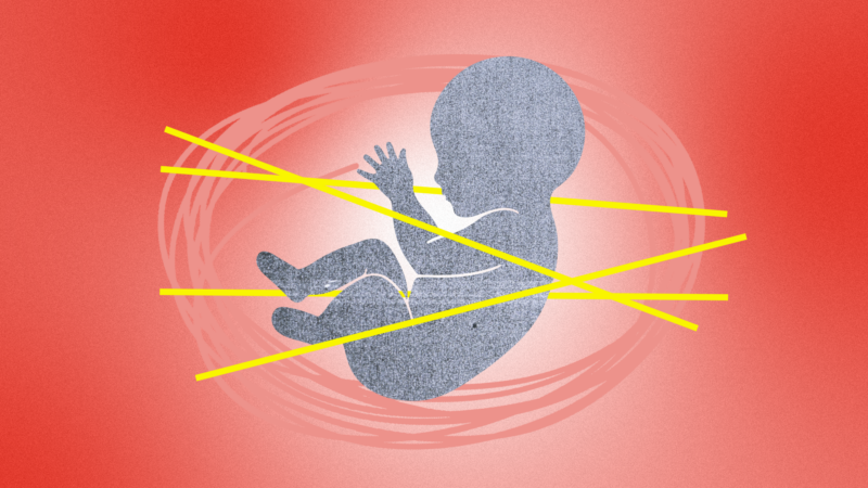 An illustration of a fetus | Illustration: Lex Villena; adapted from Julius Kliucinskas, Dreamstime.com