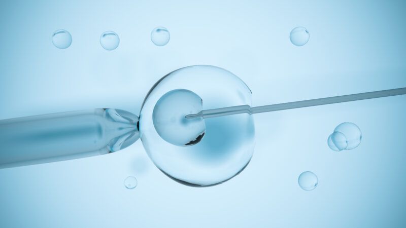 A zoomed in look at an IVF cellular procedure |  © Vchalup | Dreamstime.com