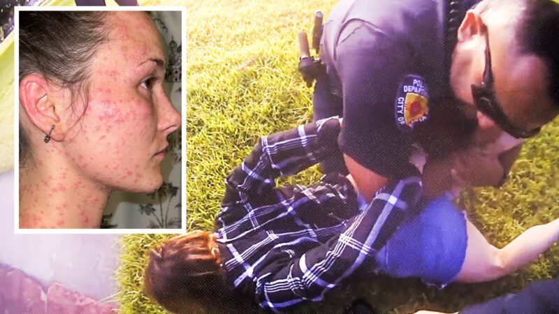 fire ant bites on Taylor Rogers next to a picture of Rogers handcuffed and held on the ground by law enforcement | Randy Kallinen
