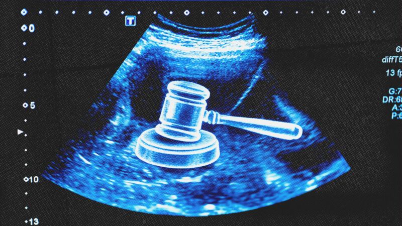 An ultrasound image showing a judge's gavel | Photo: Kohanova/Envato (AI-modified)