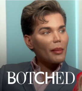 Amazing Transitions on Botched: Rodrigo Alves [E! Entertainment] YouTube