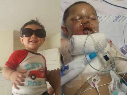 Bou Bou Phonesavanh before and after the drug raid that nearly killed him