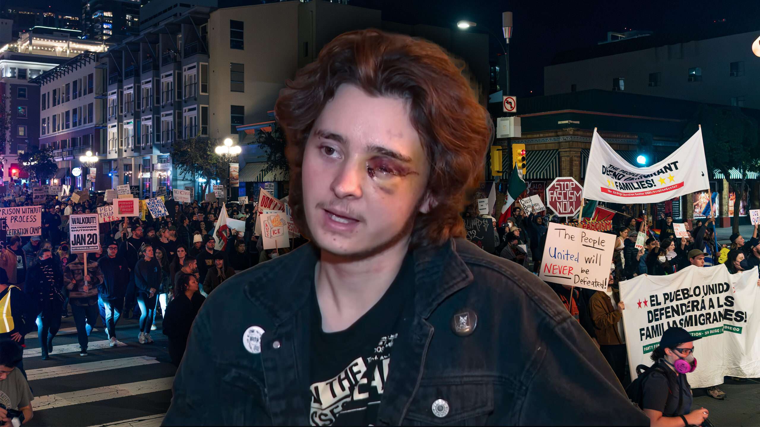 Video Shows Feds Shooting ICE Protester With Nonlethal Round at Point-Blank Range, Blinding Him in One Eye