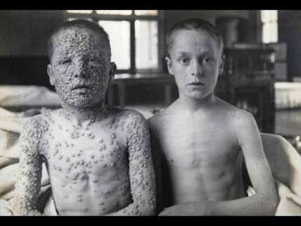 Smallpox boys