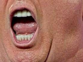 Tump Mouth