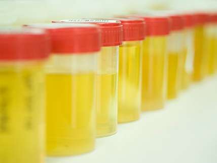 urine tests