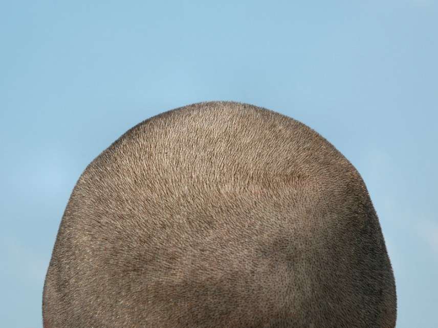 Shaved head