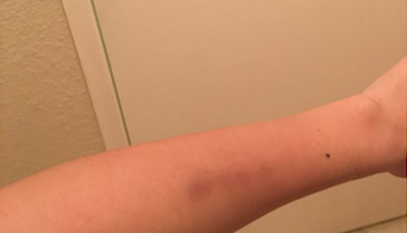 Michelle Fields' arm. ||| Michelle Fields