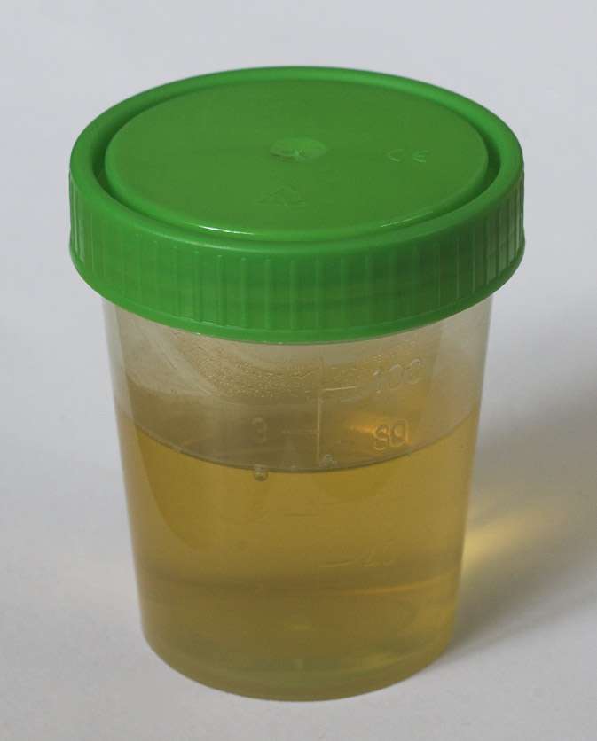 https://d2eehagpk5cl65.cloudfront.net/img/q60/uploads/assets/mc/jsullum/2015_12/urine-cup-wikipedia.jpg